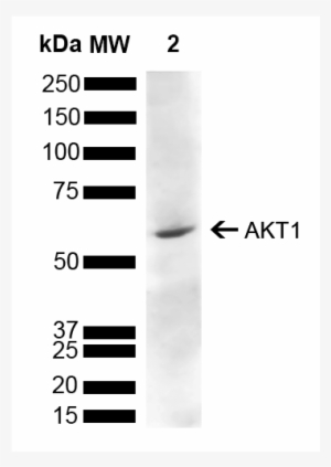Spc-789 Akt1 Antibody Wb Rat Liver 1 - Antibody