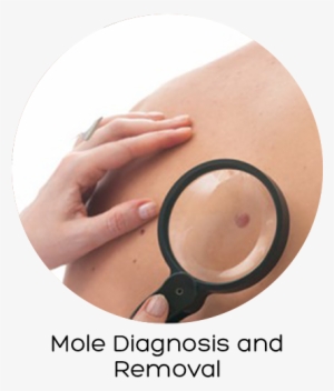 Skin Cancer