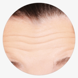 Forehead Wrinkles - Plywood