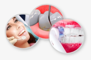 dental cleaning jumeirah dubai - dental cleaning png