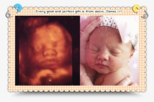 Baby Piper - Baby Face 4d Ultrasound