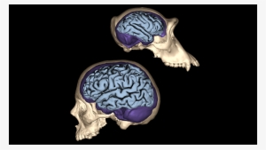 Brain Size Compared To Skull