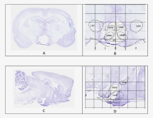 Representative Brain Sections Showing The Extent Of - Brain