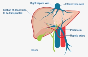 Live Donor Liver Transplantation - Liver Transplantation