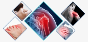 interactive body shoulder pain - polymyalgia rheumatica and giant cell arteritis by