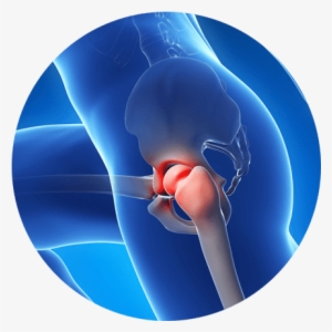 Relieve Hip Pain Without Surgery - Hip Pain Png