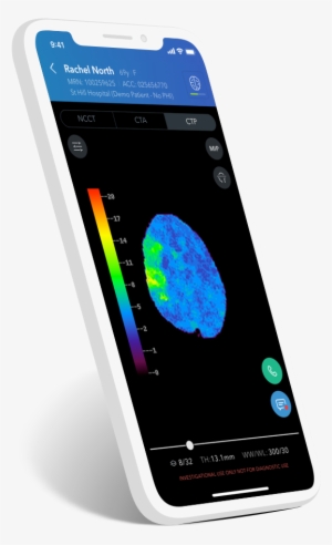iPhone X Transparent PNG: Ngắm smartphone tiên tiến nhất hiện nay với iPhone X Transparent PNG - chiếc điện thoại mang lại trải nghiệm hoàn toàn mới cho người dùng. Với các tính năng và ứng dụng ấn tượng, từ hình ảnh tinh tế đến màn hình AMOLED, bạn sẽ được khám phá những gì iPhone X có thể cung cấp. 