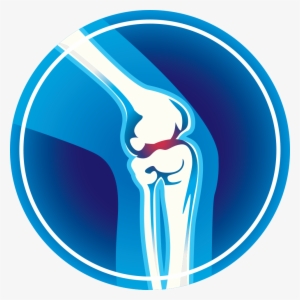 Banner Free Download Arthritis Monroe Clinic Did You - Joint Pain Clip Art