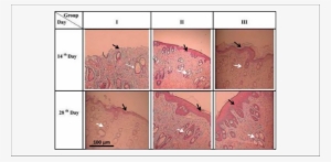Skin Photomicrographs Of Second-degree Burns Treated - Aloe Vera