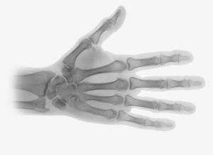 X Ray Transparent Png
