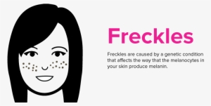 Freckles - Cartoon