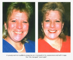 A Young Woman Suddenly Acquieres A New Smile - Woman