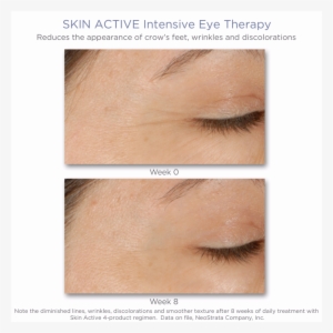 Neostrata Skin Active Intensive Eye Therapy - Neostrata Skin Active Eye Therapy