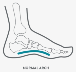 A Kids Foot Health Diagram Illustrating A Normal Arch - Illustration