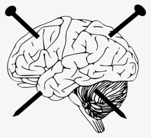 Physical Brain Damage And Amnesia - Brain Clip Art