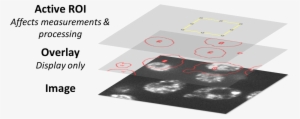 Rois And Overlays - Portable Network Graphics