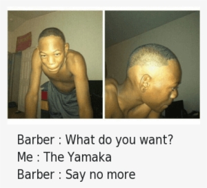 Barber What Do You Want Me The Yamaka Barber Say No - Worst Hairline In The Words