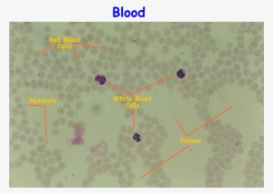 Histology - Human Blood Smear Labeled