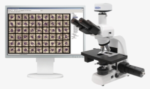 Vision Hema Automatic Digital Blood Smear Analysis - Hemavision