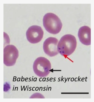 The Rising Prevalence Of Co Infections In Rodents May - Babesia Peripheral Blood Smear