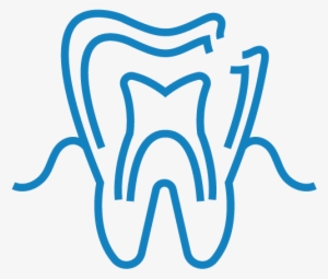 Endodontics - Illustration
