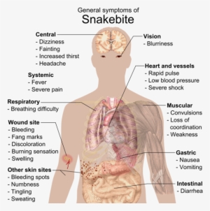 Snake Bite Symptoms - General Symptoms Of Snakebite