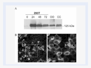 Expression Vector Containing Full-length Mater Was - Hek 293 Cells