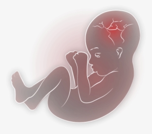 Baby In Womb Png Transparent Baby In Womb - Transparent Baby In Womb
