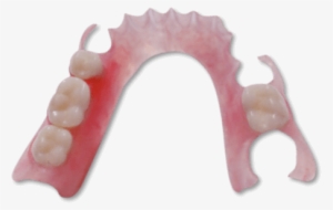 Flexible Partial Dentures - Hillock Family Dental