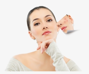 Anti-acne