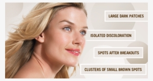 The Different Spots On Your Skin - Remove Melasma On Face