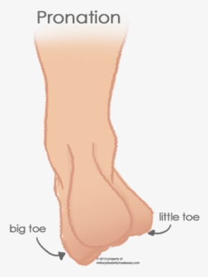 Pronation Of The Foot 3 - Flat Feet Calluses