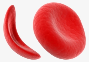 What Is Sickle Cell Disease - Sickle Cell Anemia Transparent