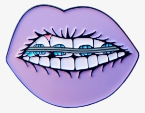 Report Abuse - Lips With Braces Drawing