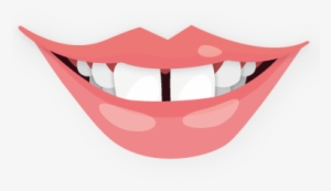 Aumento De Labios - Orthodontics