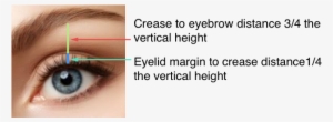 Eye Lift Women Diagram - Eyelid