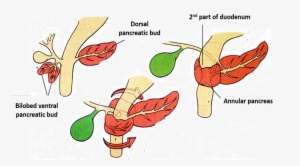 Pancreas - Annular - Dorsal Ventral Pancreatic Buds