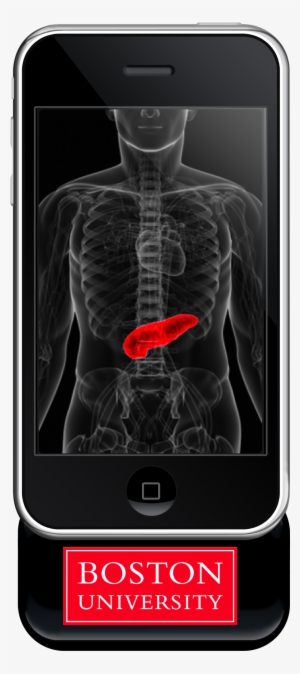 034 Pancreas Phone - Advances In Liver Transplantation [book]
