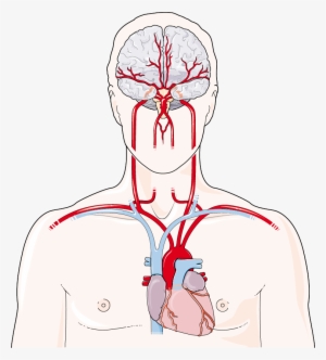Artères Cérébrales - Artery