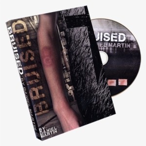 Today, When You Order "bruised By Daniel Martin \ - Mms Bruised By Daniel Martin - Trick
