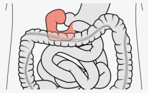Duodenum Of The Small Intestine Being Squirted