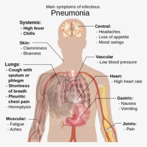 800px-symptoms Of Pneumonia - Pneumonia Sign And Symptom