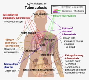 “symptoms Of Tuberculosis - Respiratory System Tuberculosis