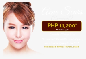 Acne Scar Removal Coupon - Beverly Hills Medical Group