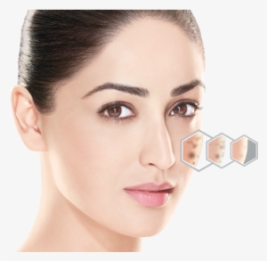 Read About The Benefits Of Fair & Lovely Advanced Multivitamin - Fair And Lovely For Dark Spots