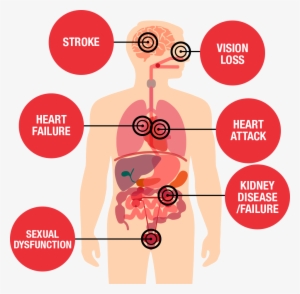 Health Threats Diagram - High Blood Pressure Effects