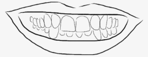 Overbite - Line Art