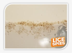 lice spies 6 month battle png - head lice 2018