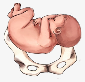 Transverse Baby - Lateral Position Of Baby
