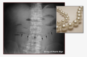 String Of Pearls Png Download - String Of Pearls Sign